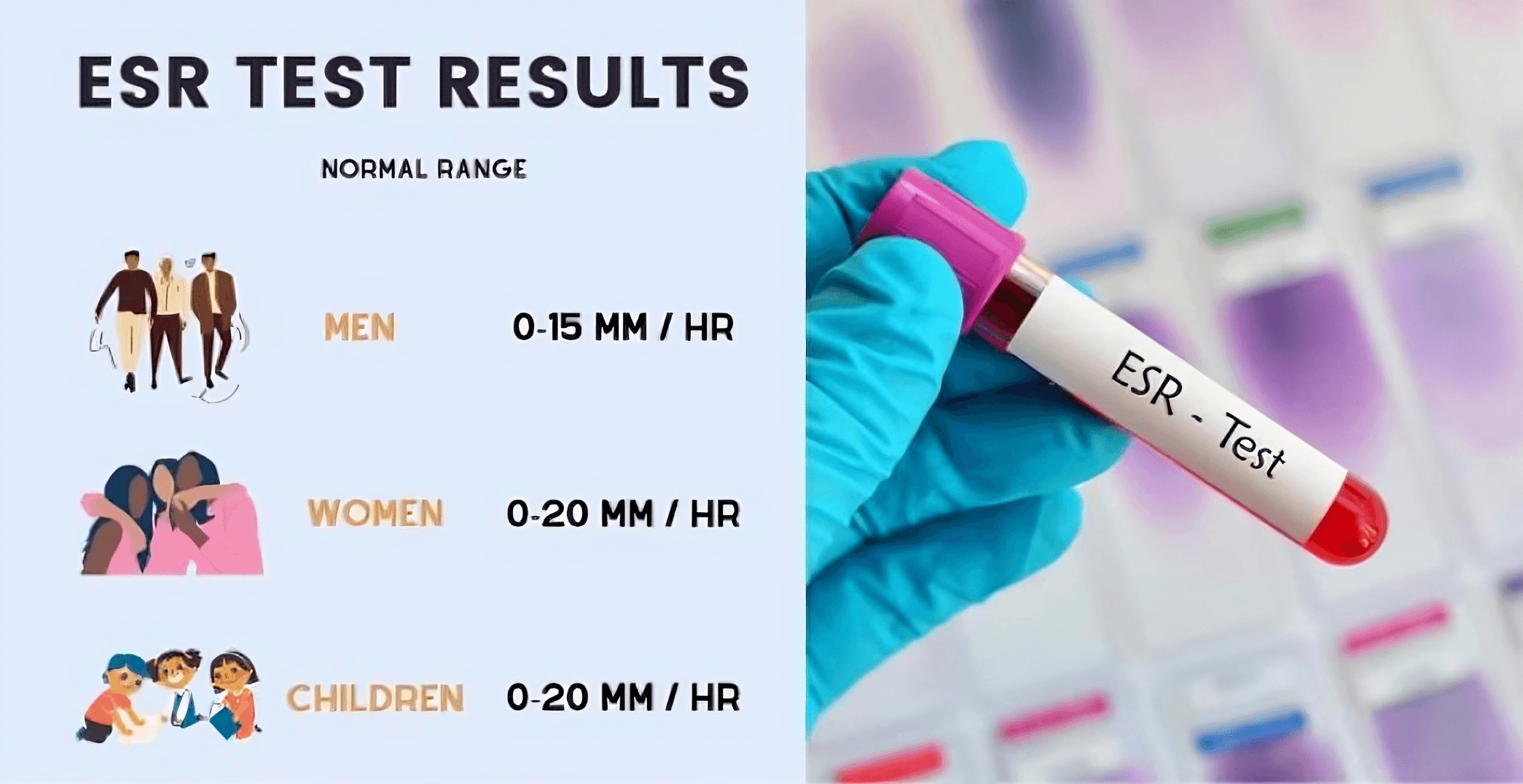 ESR (Erythrocyte Sedimentation Rate)