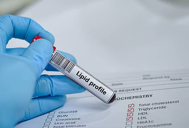 Lipid Profile